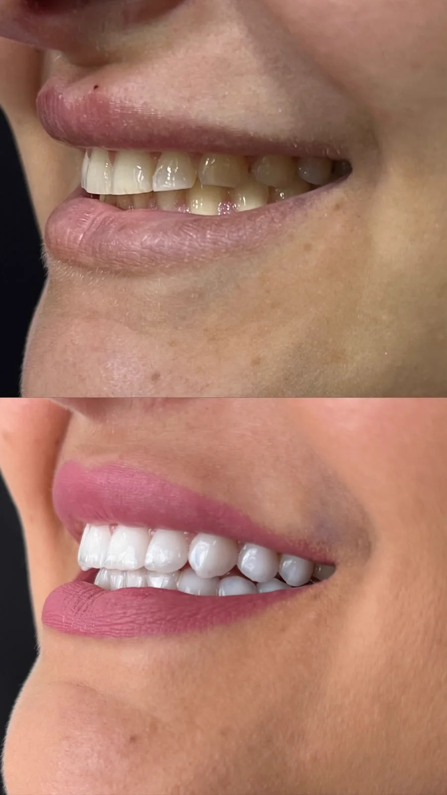 Comparativo de resultado odontológico antes e depois