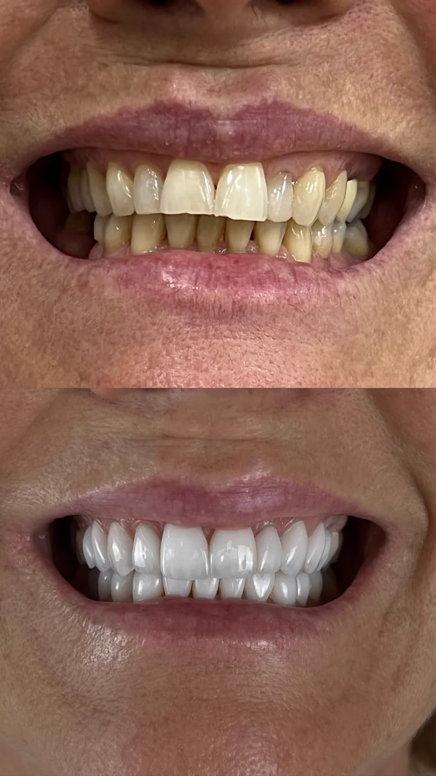 Comparativo de resultado odontológico antes e depois